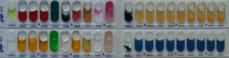 API 20 E Biomerieux