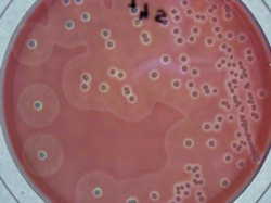 Staphylococcus aureus